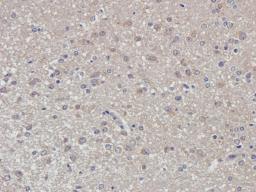 Immunohistochemical staining of rat brain tissue using Dopamine D2 receptor antibody (2.5 ug/ml)