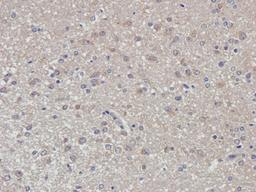 Immunohistochemical staining of rat brain tissue using Dopamine D2 receptor antibody (2.5 ug/ml)