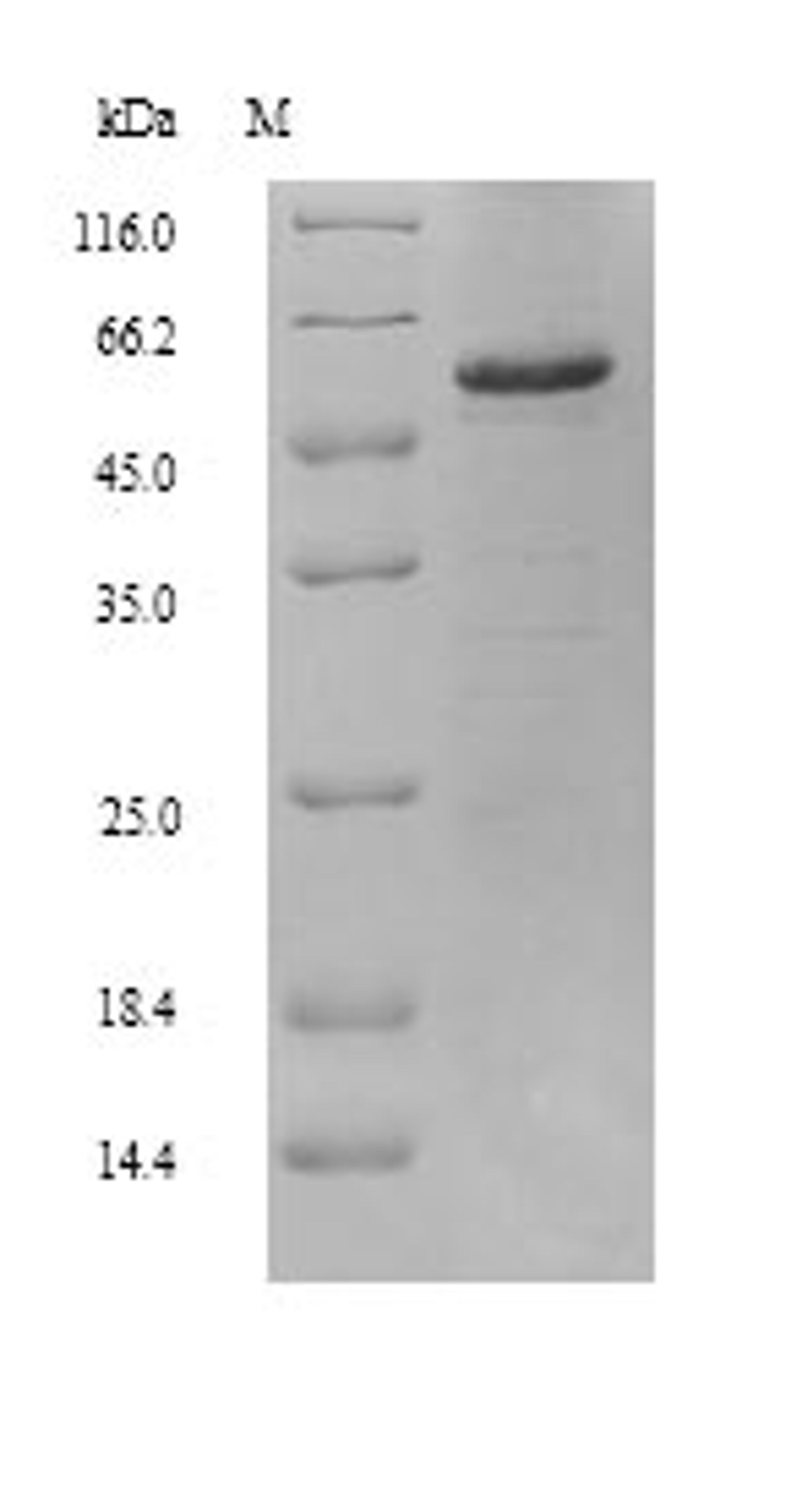 (Tris-Glycine gel) Discontinuous SDS-PAGE (reduced) with 5% enrichment gel and 15% separation gel.