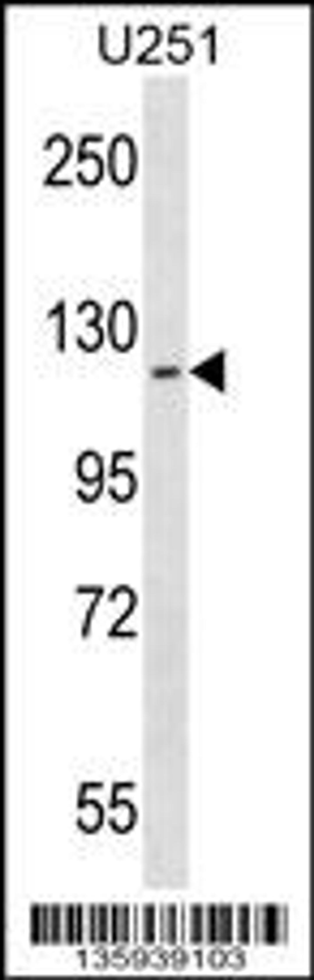 Western blot analysis in U251 cell line lysates (35ug/lane).