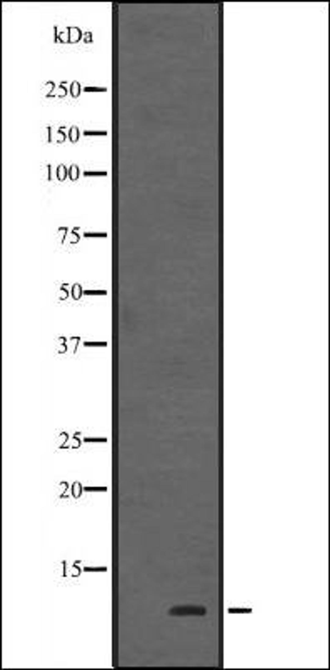 Western blot analysis of Human fetal heart tissue lysate using HOP antibody