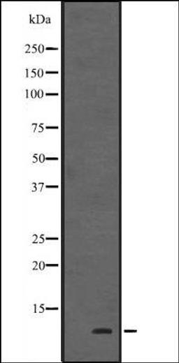 Western blot analysis of Human fetal heart tissue lysate using HOP antibody