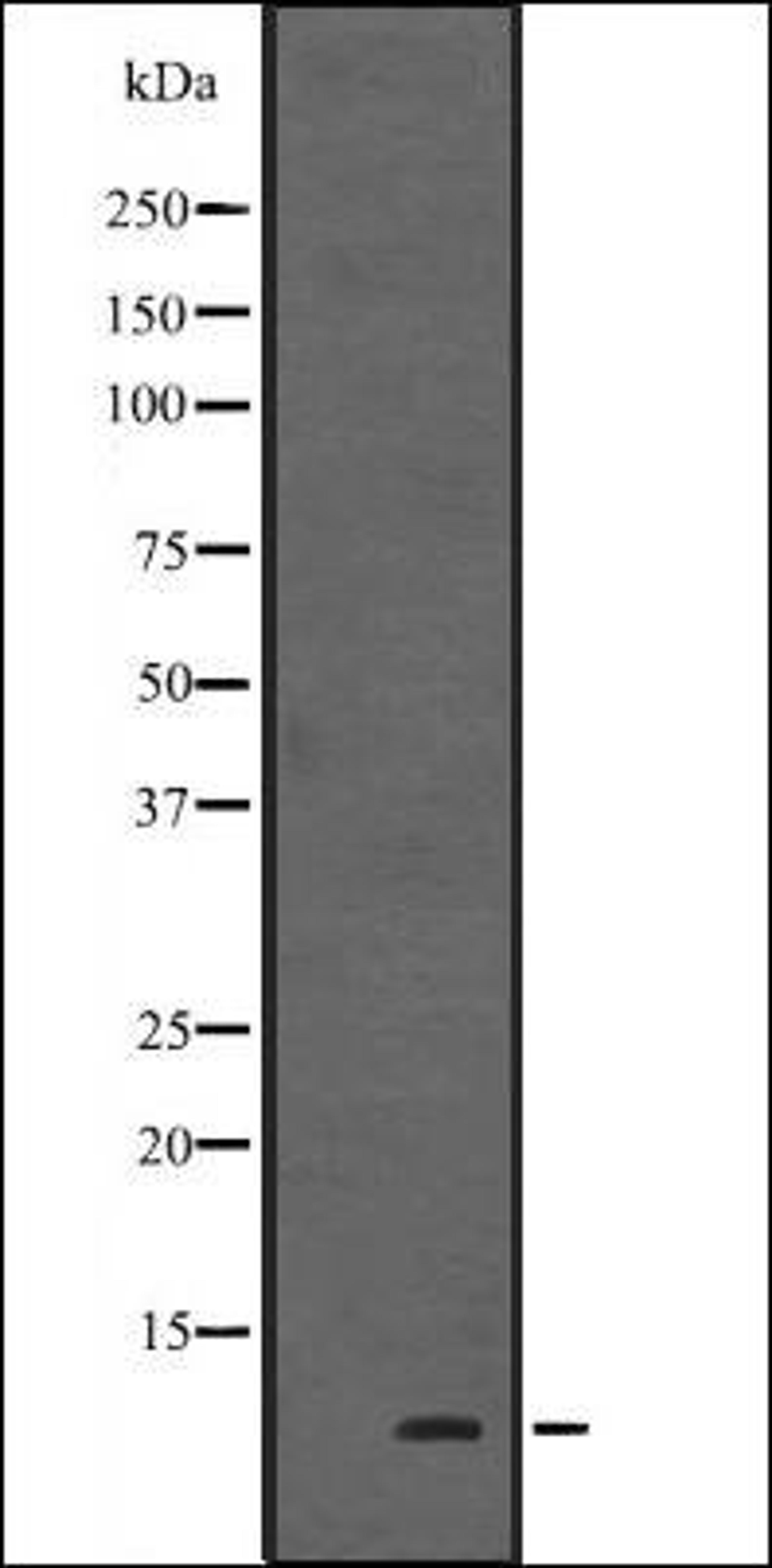 Western blot analysis of Human fetal heart tissue lysate using HOP antibody