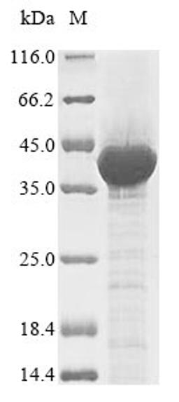 (Tris-Glycine gel) Discontinuous SDS-PAGE (reduced) with 5% enrichment gel and 15% separation gel.