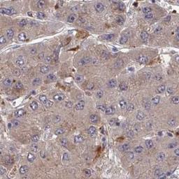 Immunohistochemistry: FJX1 Antibody [NBP2-32442] - liver cancer