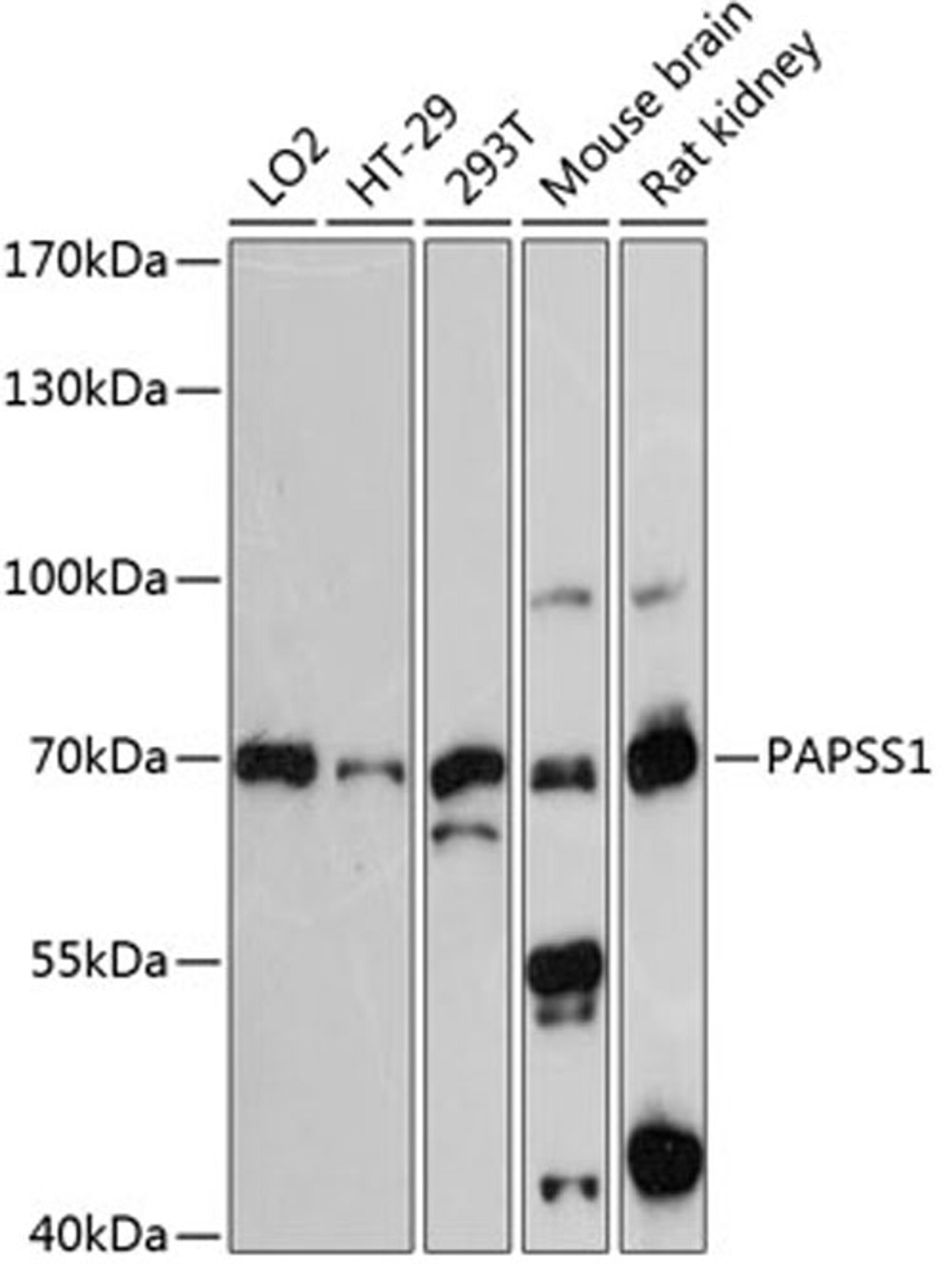 Western blot - PAPSS1 antibody (A13773)