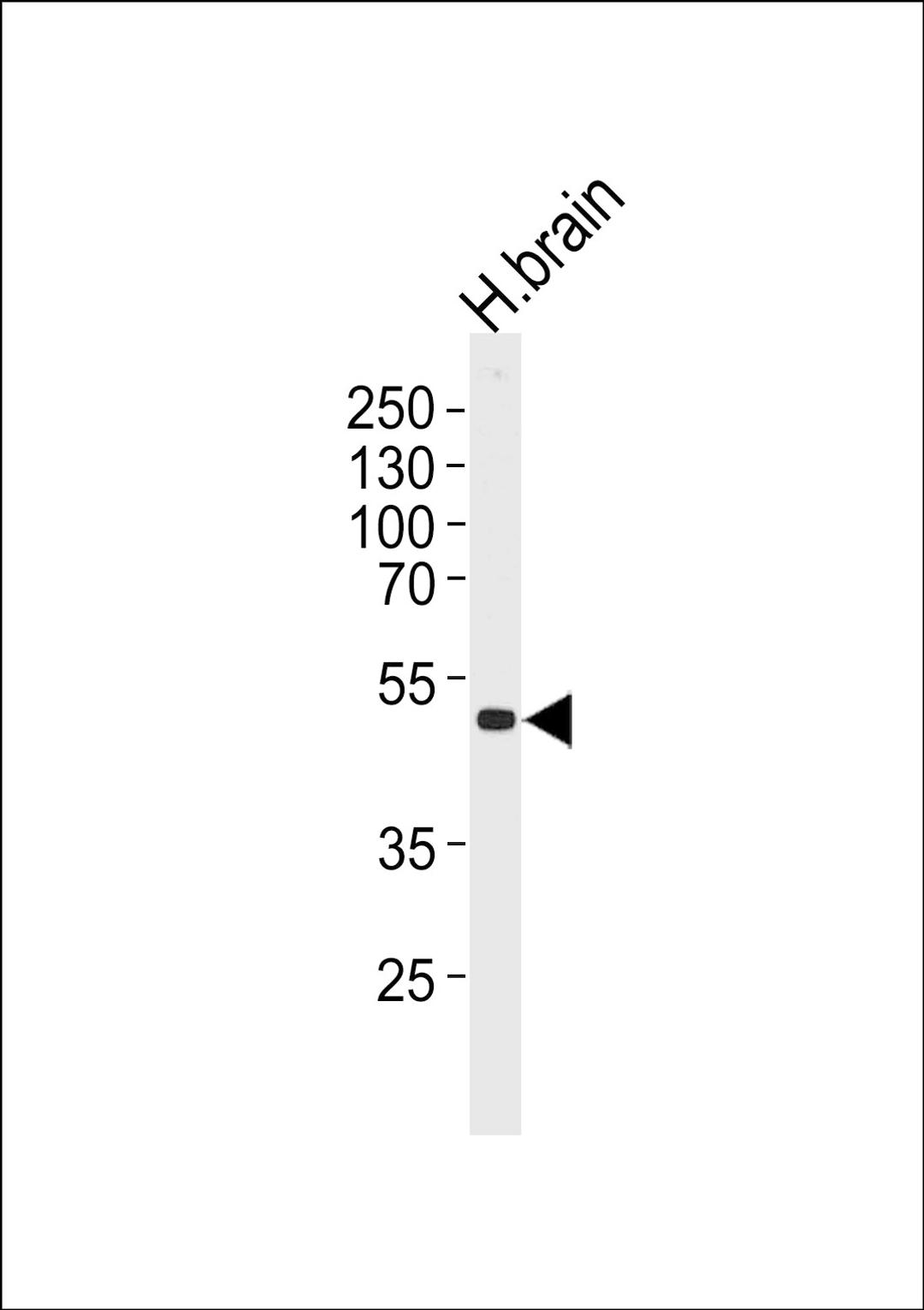 Western blot analysis of lysate from human brain tissue lysate, using KCNJ12 Antibody at 1:1000 at each lane.