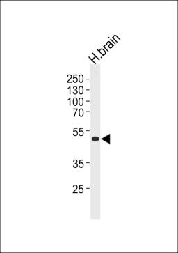 Western blot analysis of lysate from human brain tissue lysate, using KCNJ12 Antibody at 1:1000 at each lane.