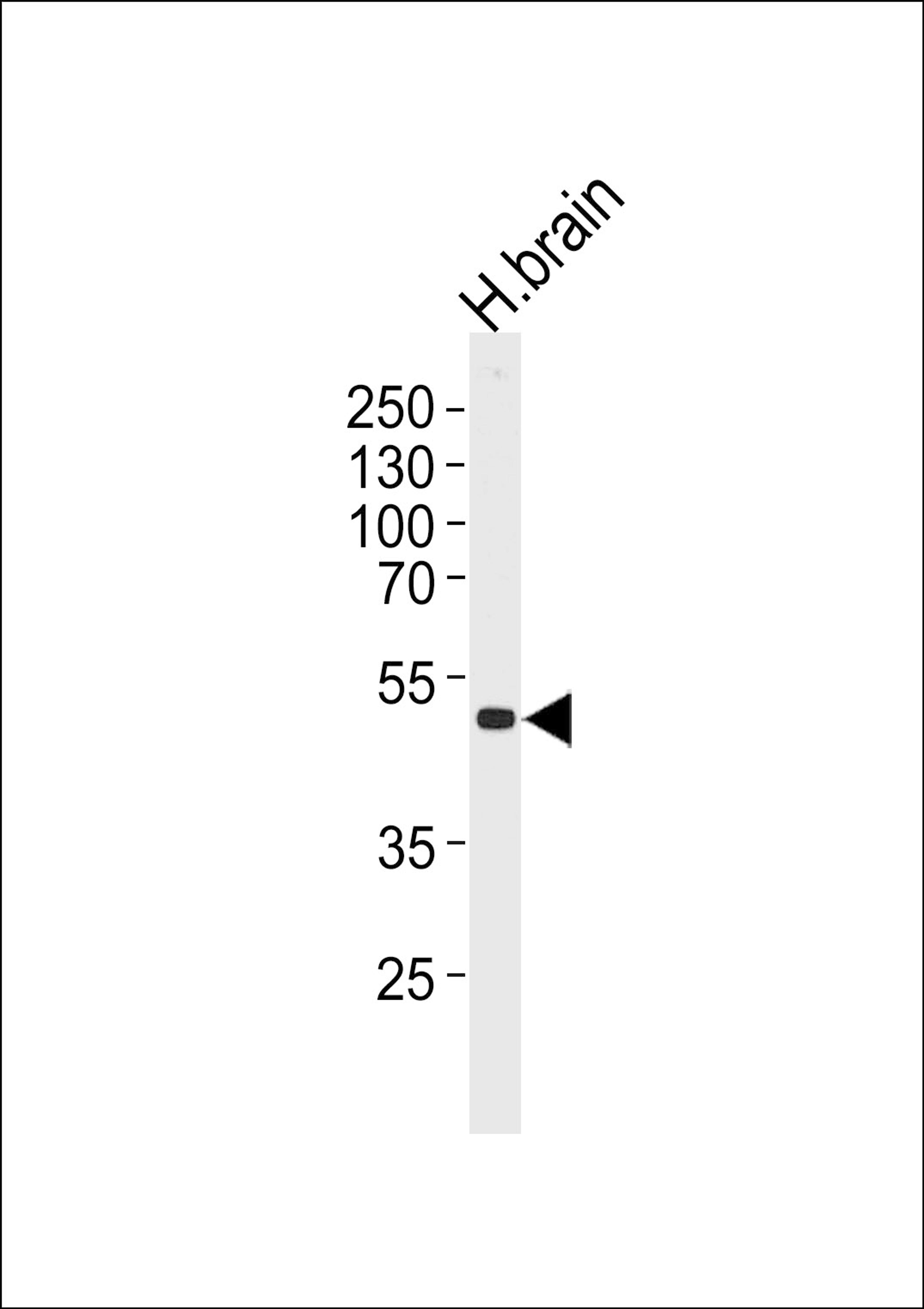 Western blot analysis of lysate from human brain tissue lysate, using KCNJ12 Antibody at 1:1000 at each lane.