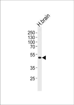 Western blot analysis of lysate from human brain tissue lysate, using KCNJ12 Antibody at 1:1000 at each lane.
