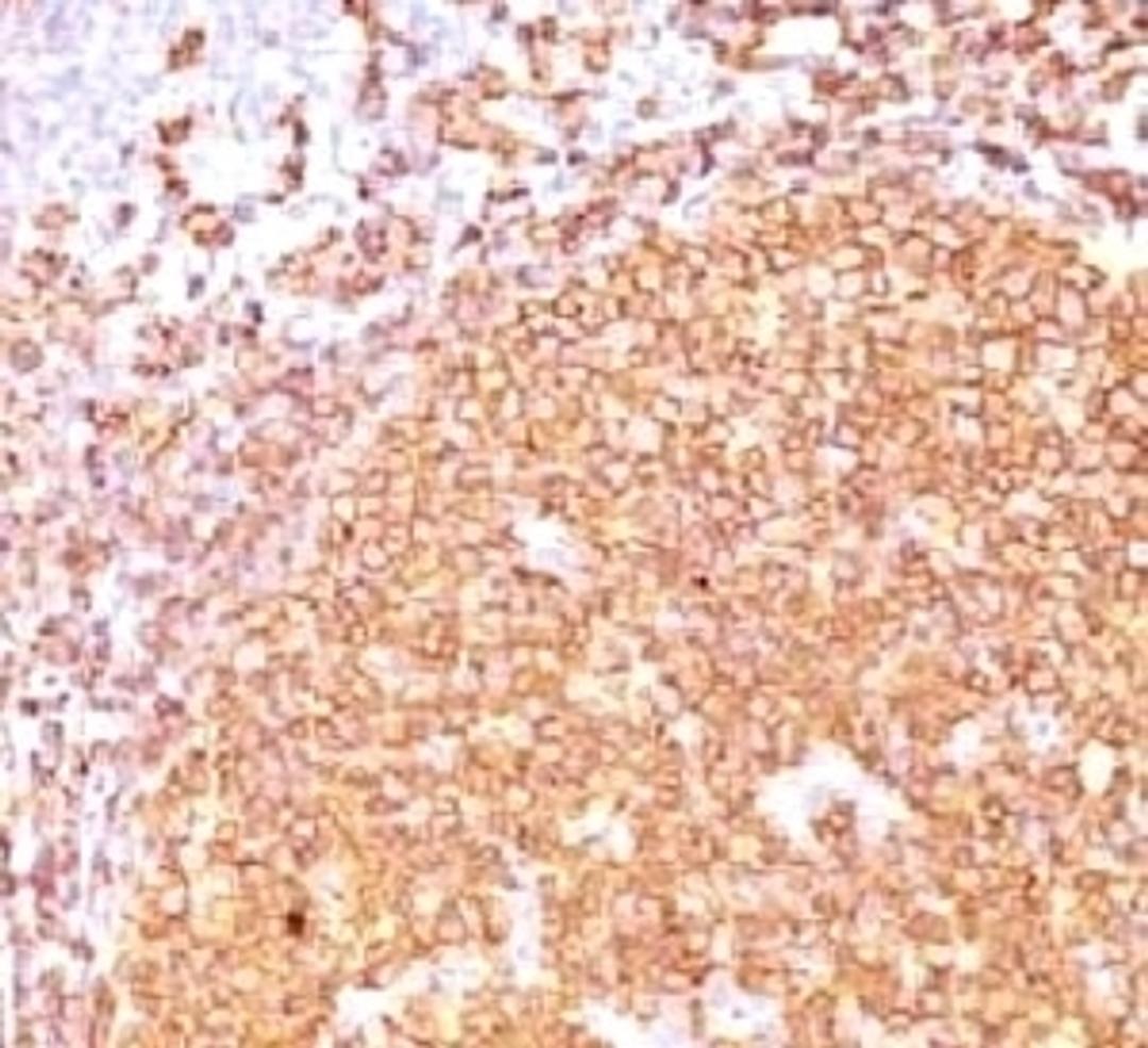 IHC testing of CD20 antibody and FFPE human tonsil tissue