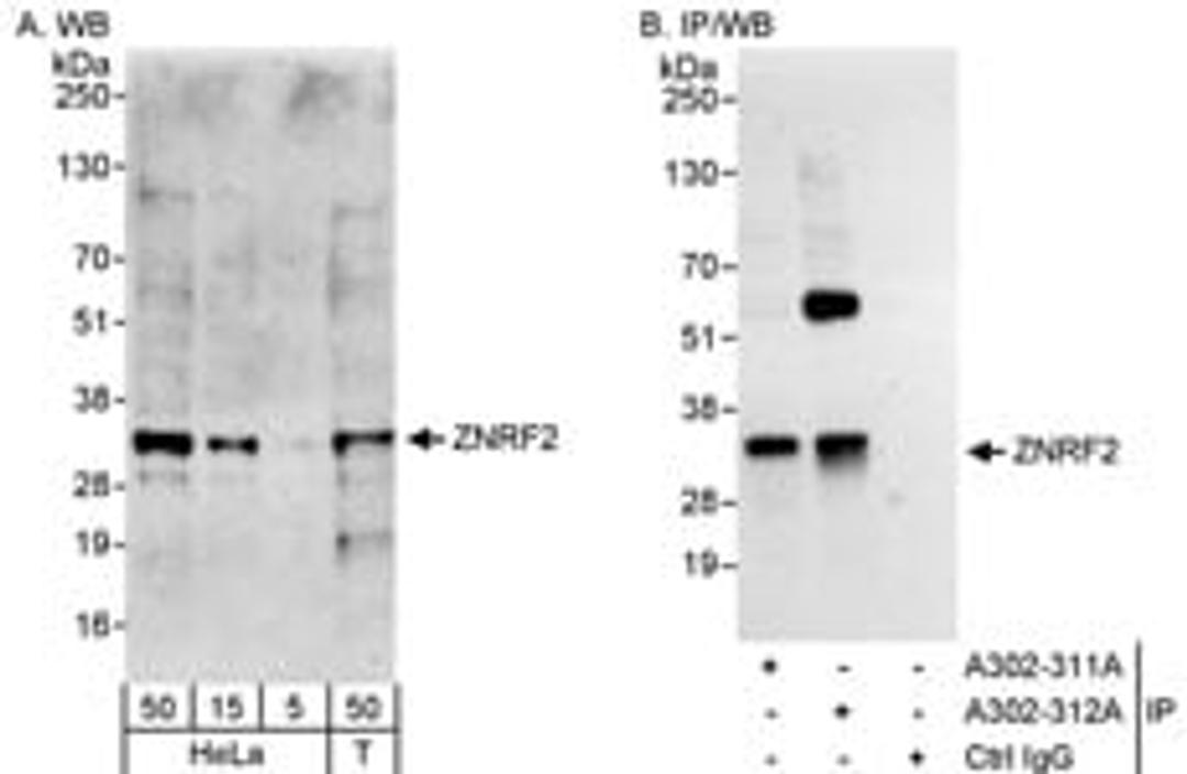 Detection of human ZNRF2 by western blot and immunoprecipitation.