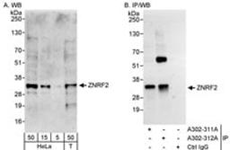 Detection of human ZNRF2 by western blot and immunoprecipitation.