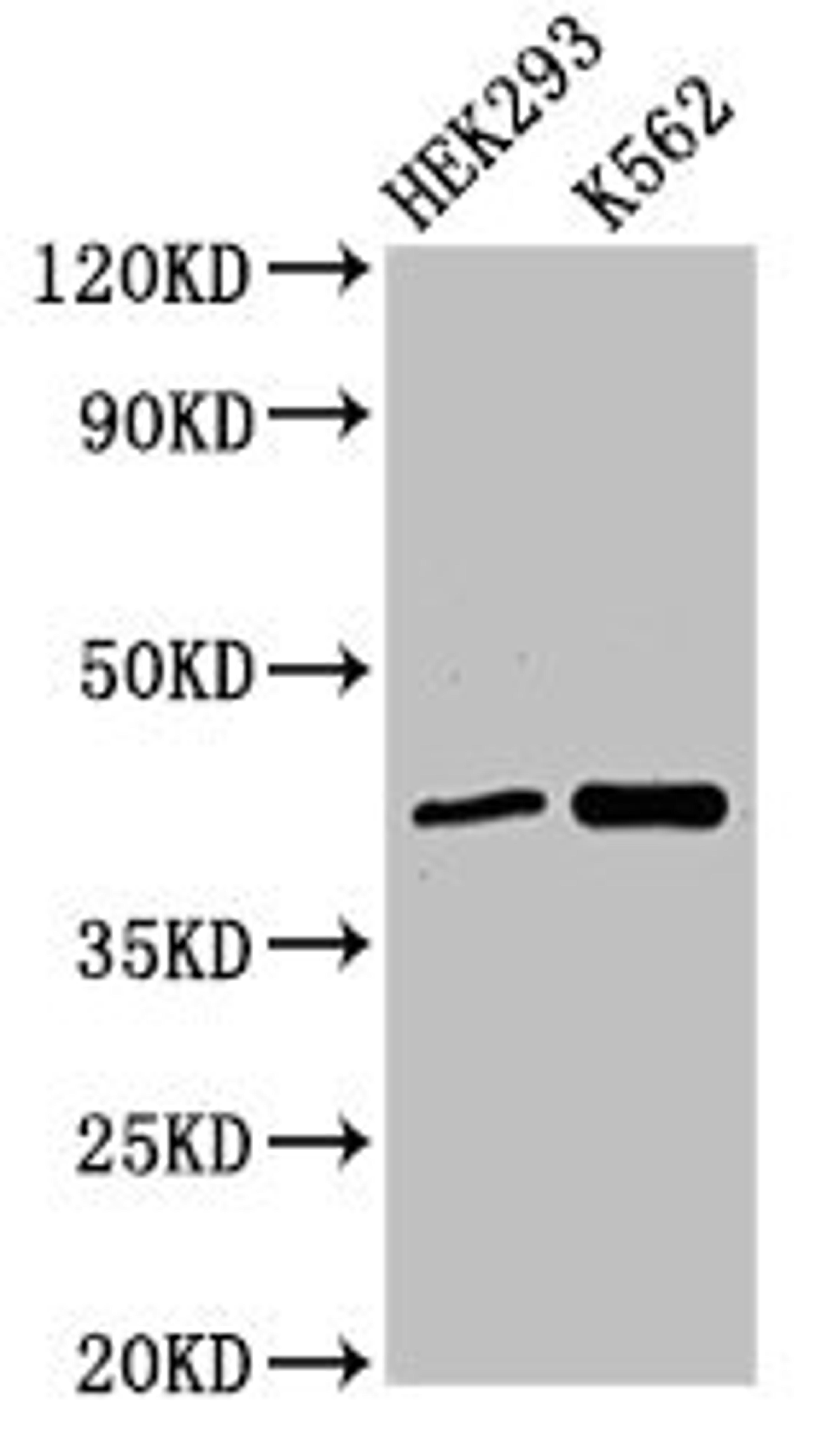 Western Blot. Positive WB detected in: HEK293 whole cell lysate, K562 whole cell lysate. All lanes: FANCF antibody at 3ug/ml. Secondary. Goat polyclonal to rabbit IgG at 1/50000 dilution. Predicted band size: 43 kDa. Observed band size: 43 kDa