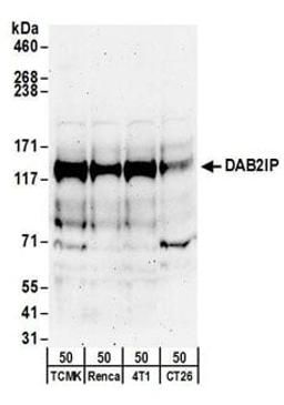 Detection of mouse DAB2IP by western blot.