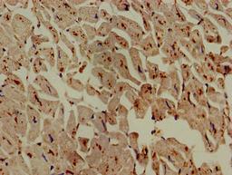 Immunohistochemistry of paraffin-embedded human heart tissue using CSB-PA619774LA01HU at dilution of 1:100