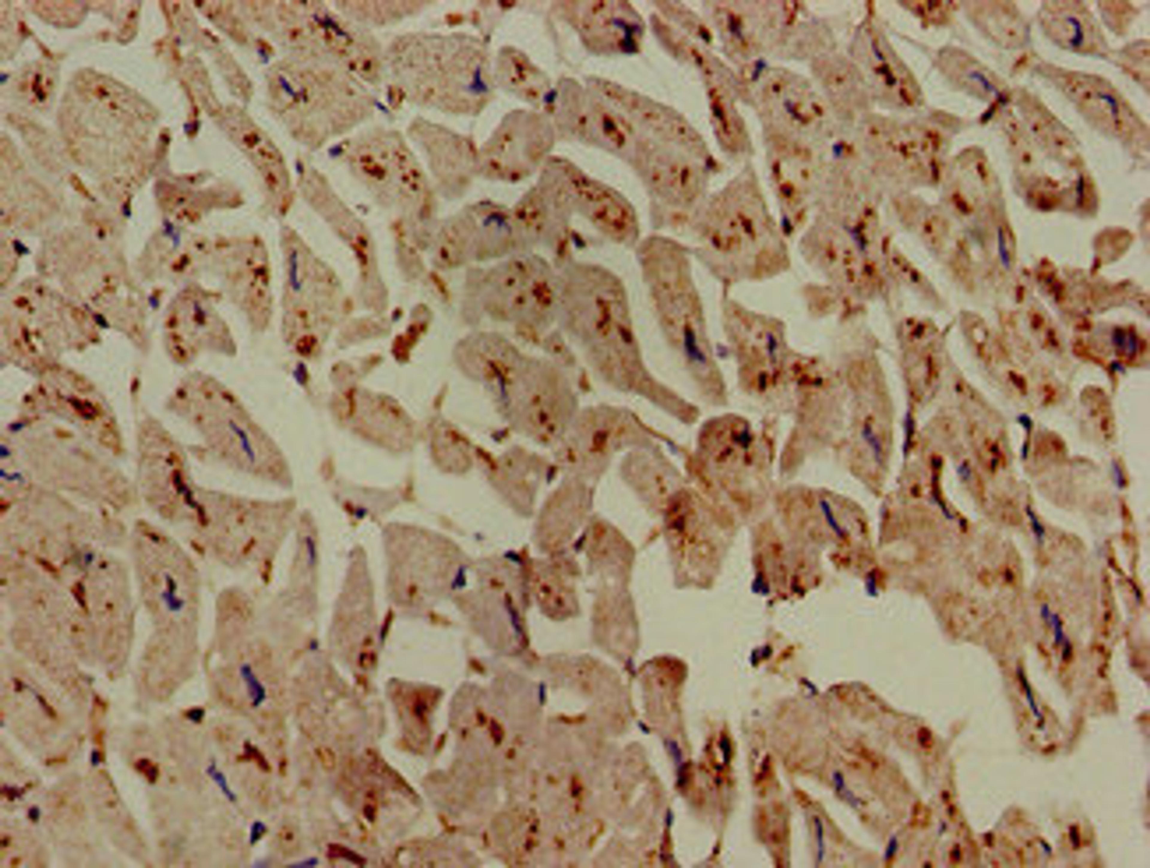 Immunohistochemistry of paraffin-embedded human heart tissue using CSB-PA619774LA01HU at dilution of 1:100