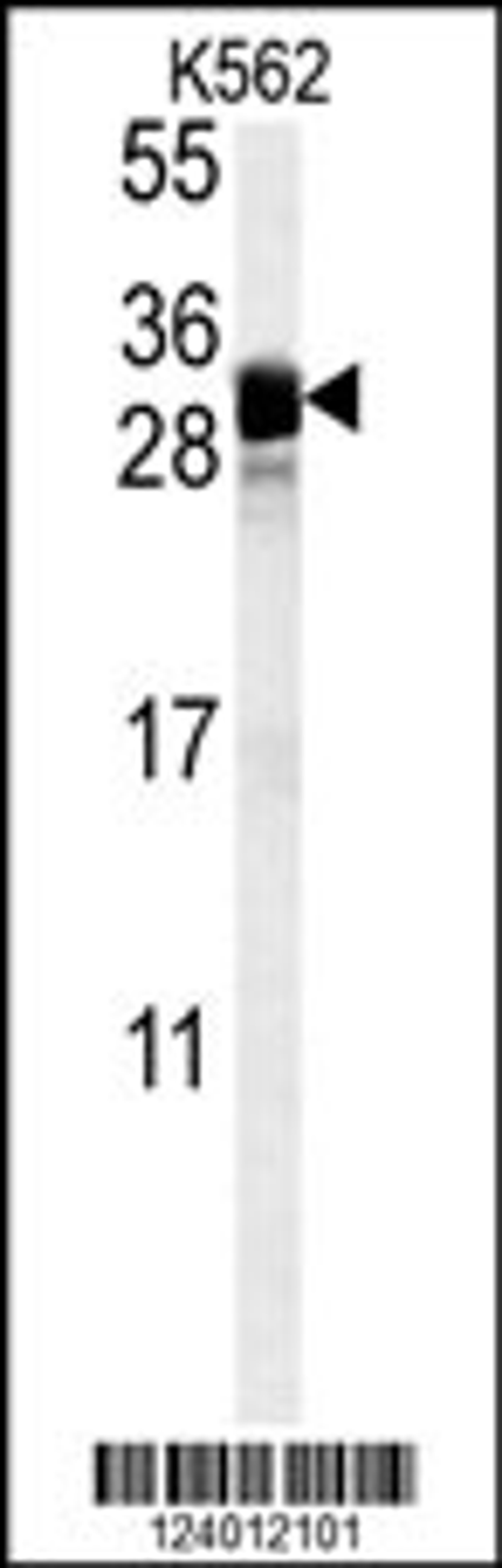 Western blot analysis in K562 cell line lysates (35ug/lane).