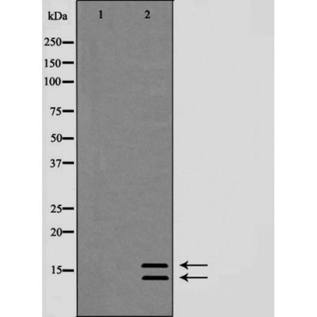 Western blot analysis of HeLa whole cell lysate using LC3A/B antibody