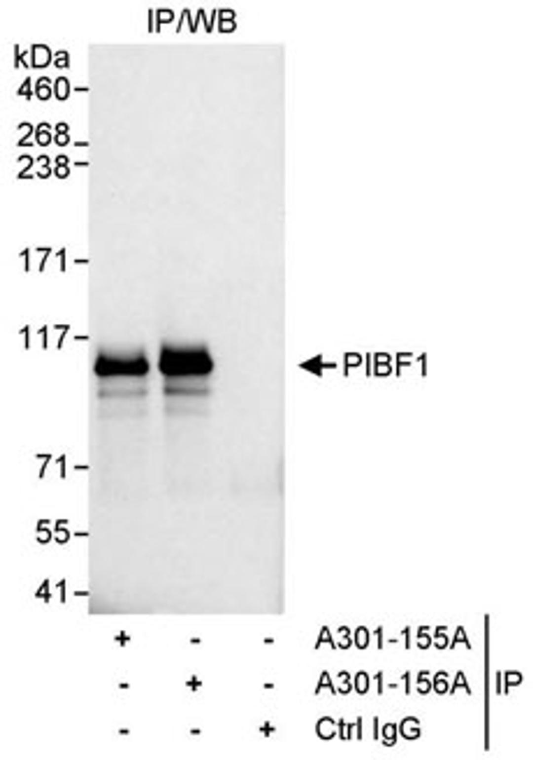 Detection of human PIBF1 by western blot of immunoprecipitates.