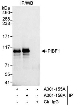 Detection of human PIBF1 by western blot of immunoprecipitates.