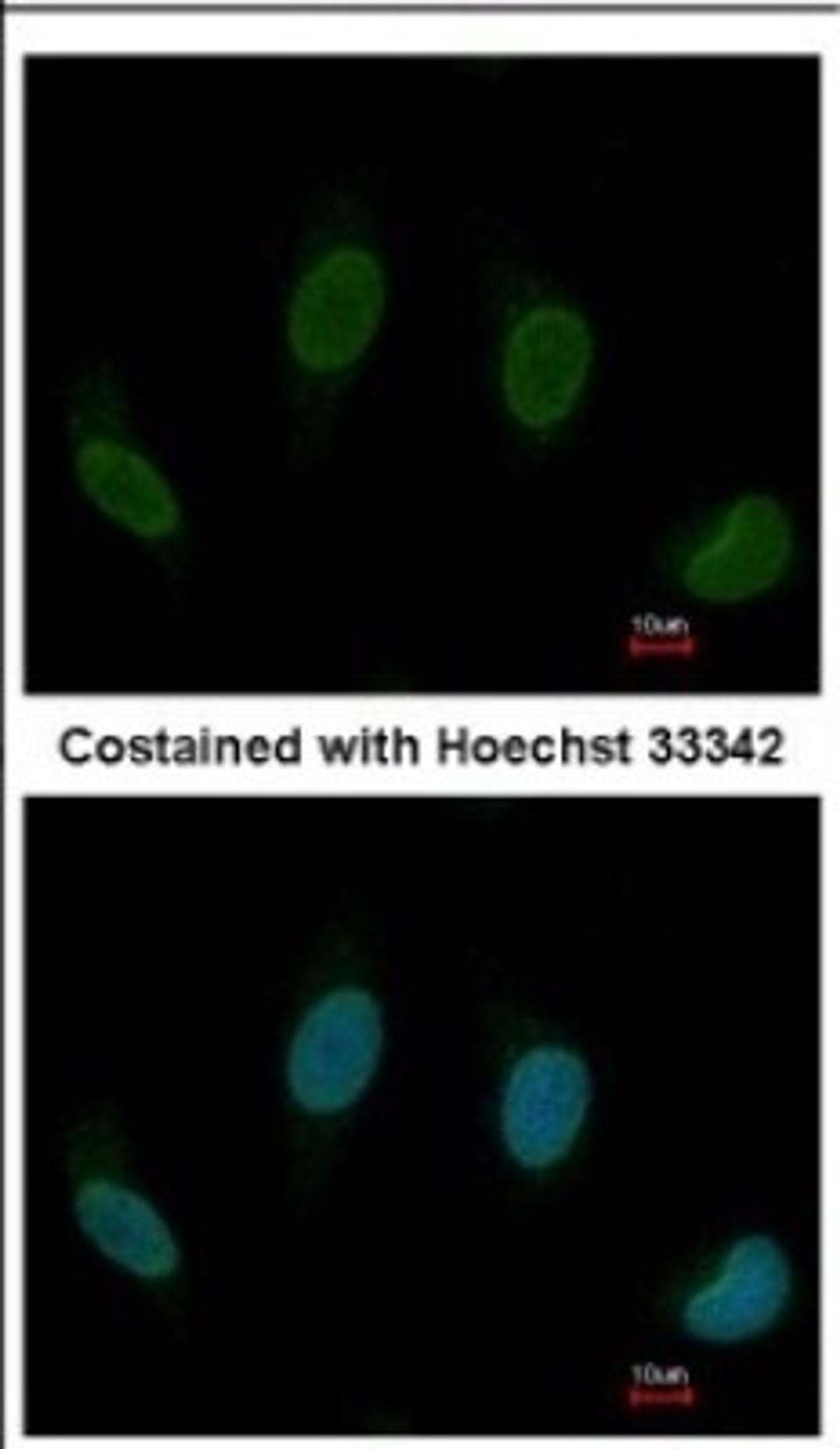 Immunocytochemistry/Immunofluorescence: TTC40 Antibody [NBP2-15632] - Immunofluorescence analysis of methanol-fixed HeLa, using antibody at 1:200 dilution.