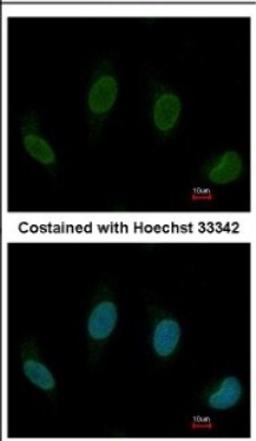 Immunocytochemistry/Immunofluorescence: TTC40 Antibody [NBP2-15632] - Immunofluorescence analysis of methanol-fixed HeLa, using antibody at 1:200 dilution.