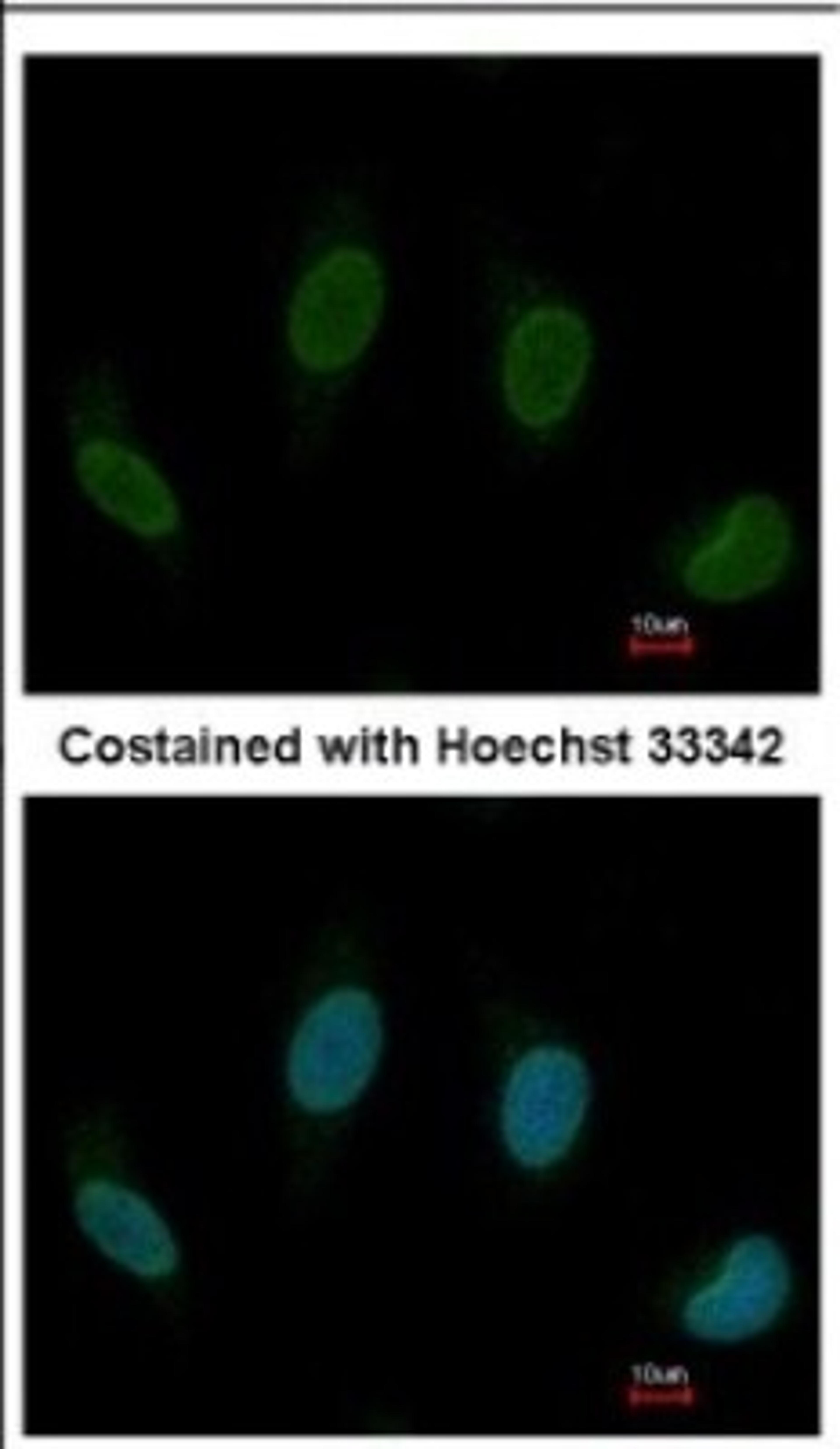 Immunocytochemistry/Immunofluorescence: TTC40 Antibody [NBP2-15632] - Immunofluorescence analysis of methanol-fixed HeLa, using antibody at 1:200 dilution.