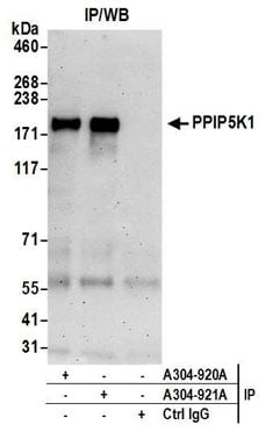 Detection of human PPIP5K1 by western blot of immunoprecipitates.