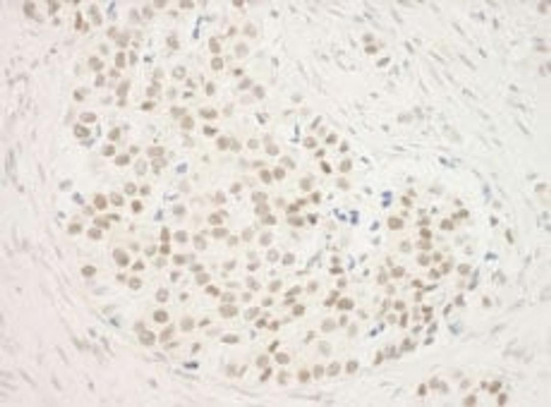 Detection of human ZNF768 by immunohistochemistry.