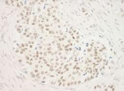 Detection of human ZNF768 by immunohistochemistry.