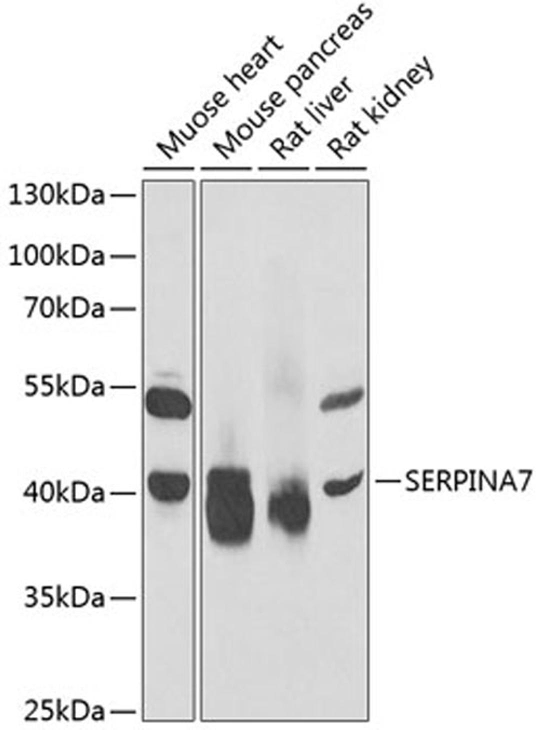 Western blot - SERPINA7 antibody (A6313)