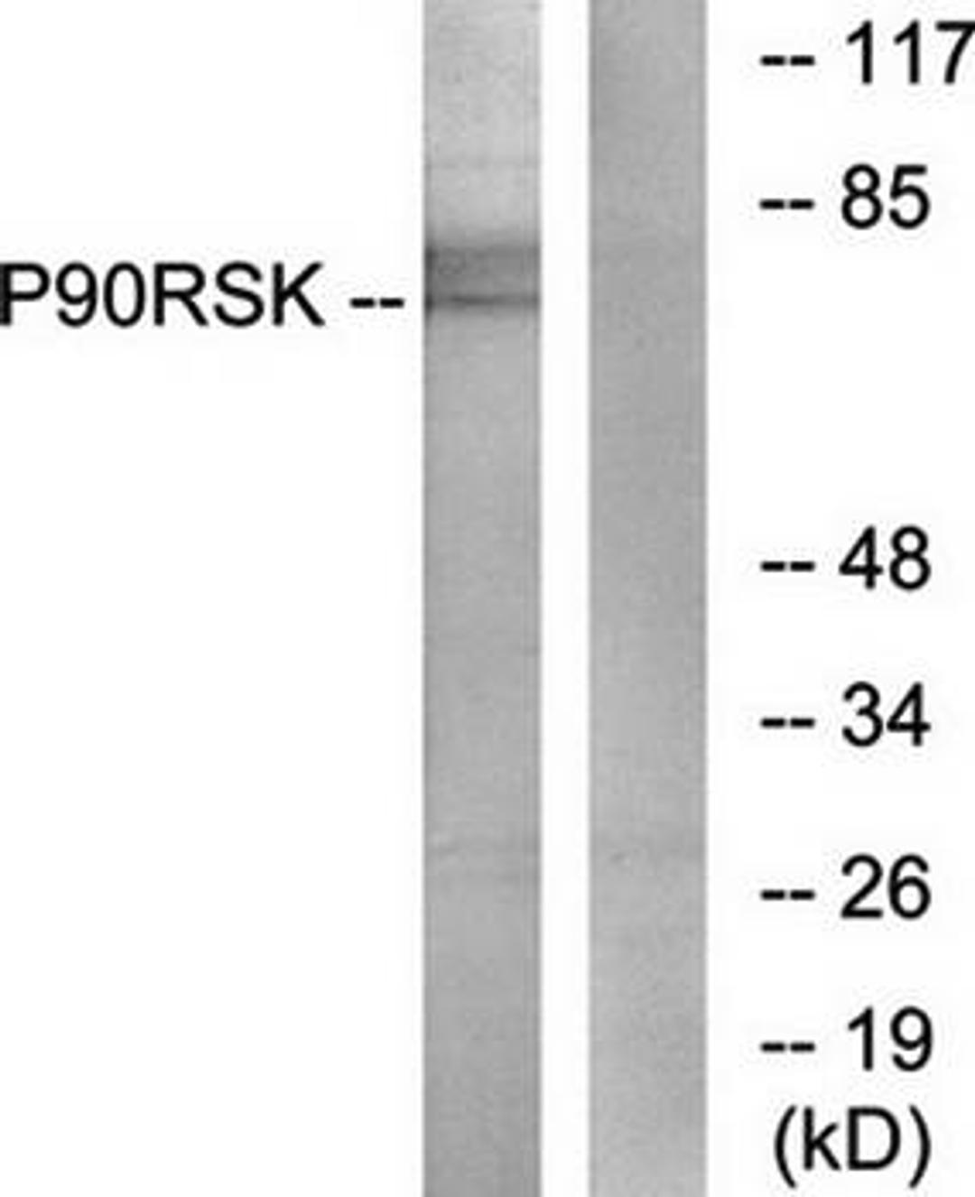 Western blot analysis of extracts from 3T3 cells using p90 RSK antibody