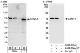 Detection of human CENP-T by western blot and immunoprecipitation.