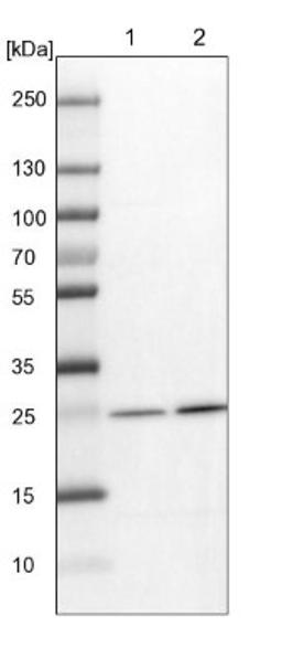 Western Blot: Biliverdin Reductase B/BLVRB Antibody [NBP1-83435] - Lane 1: NIH-3T3 cell lysate (Mouse embryonic fibroblast cells)<br/>Lane 2: NBT-II cell lysate (Rat Wistar bladder tumour cells)