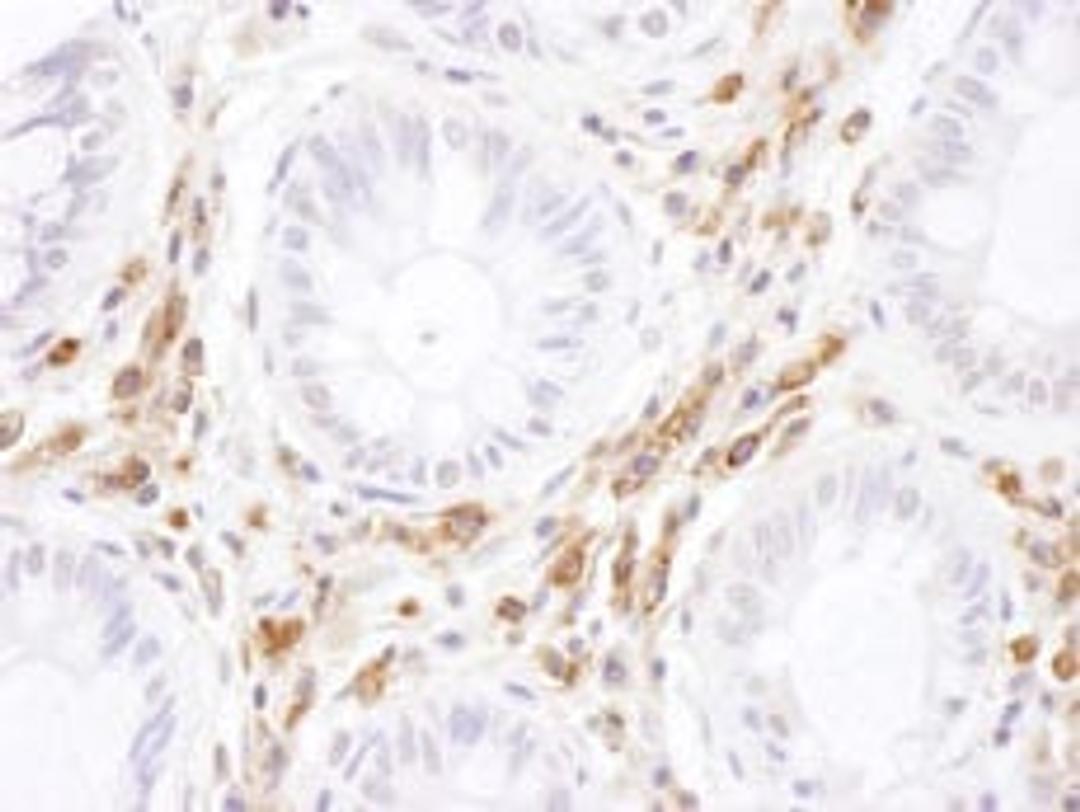 Detection of human ICAM-3 by immunohistochemistry.