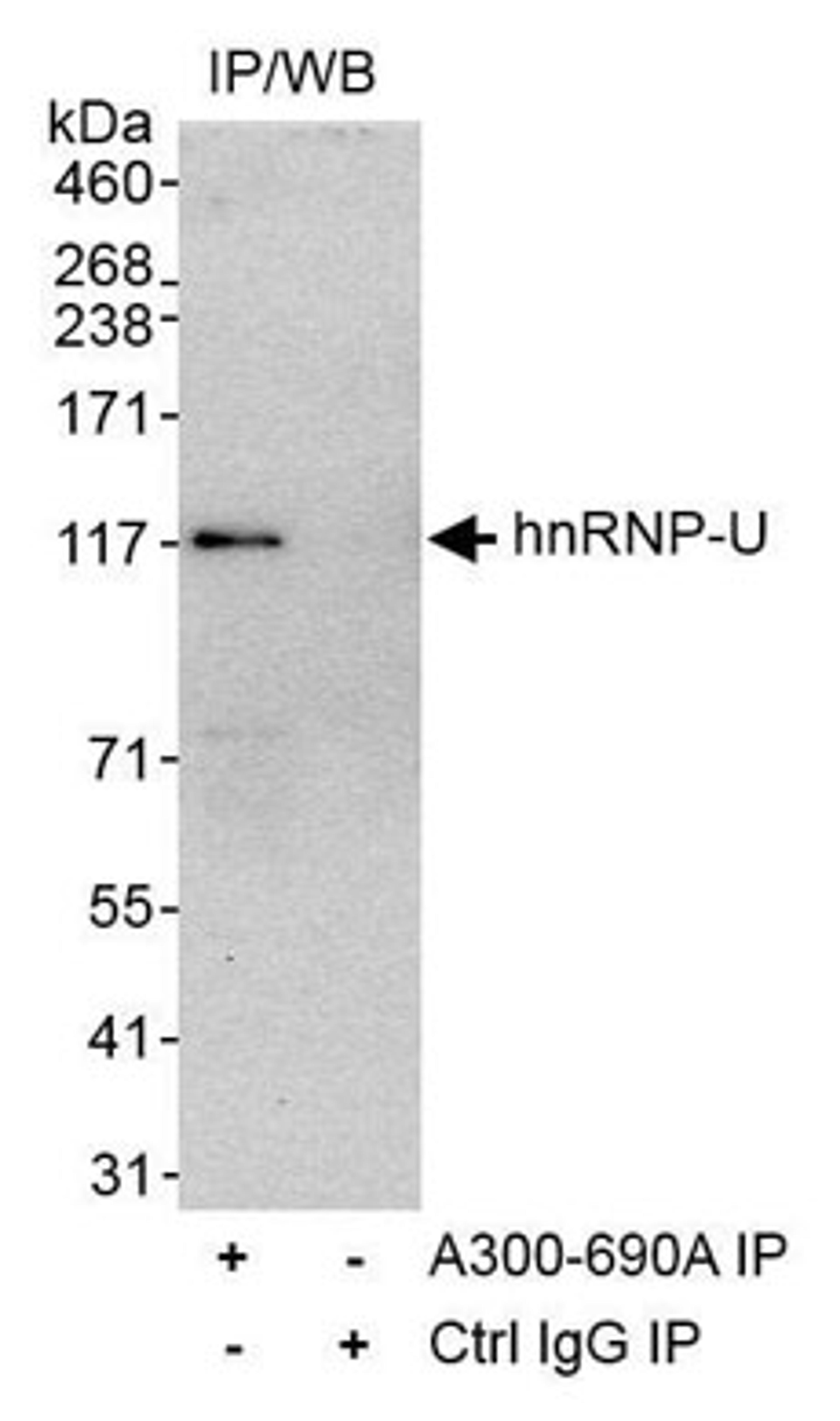 Detection of human hnRNP-U by western blot of immunoprecipitates.