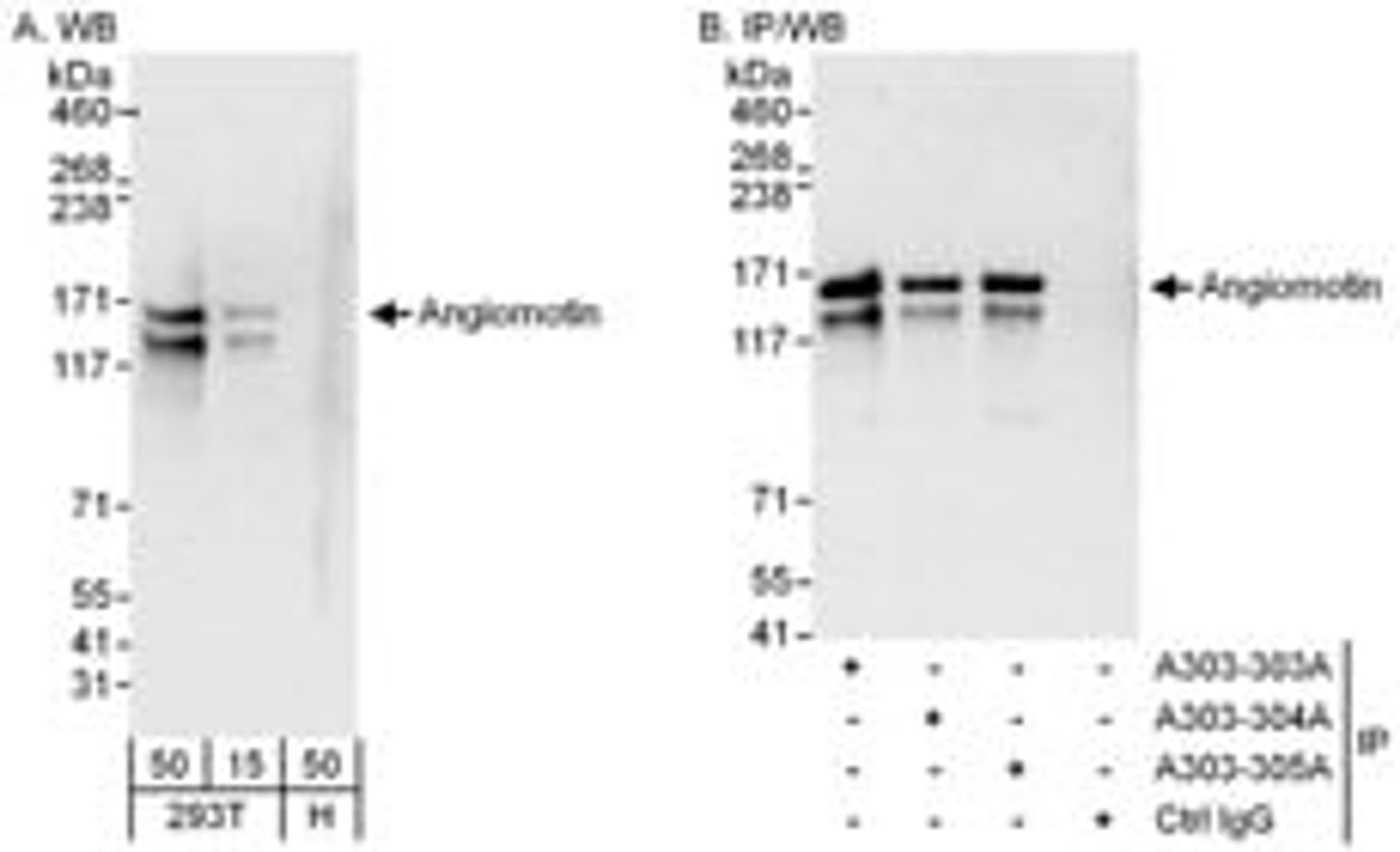 Detection of human Angiomotin by western blot and immunoprecipitation.