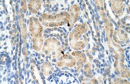 Antibody used in IHC on Human kidney.