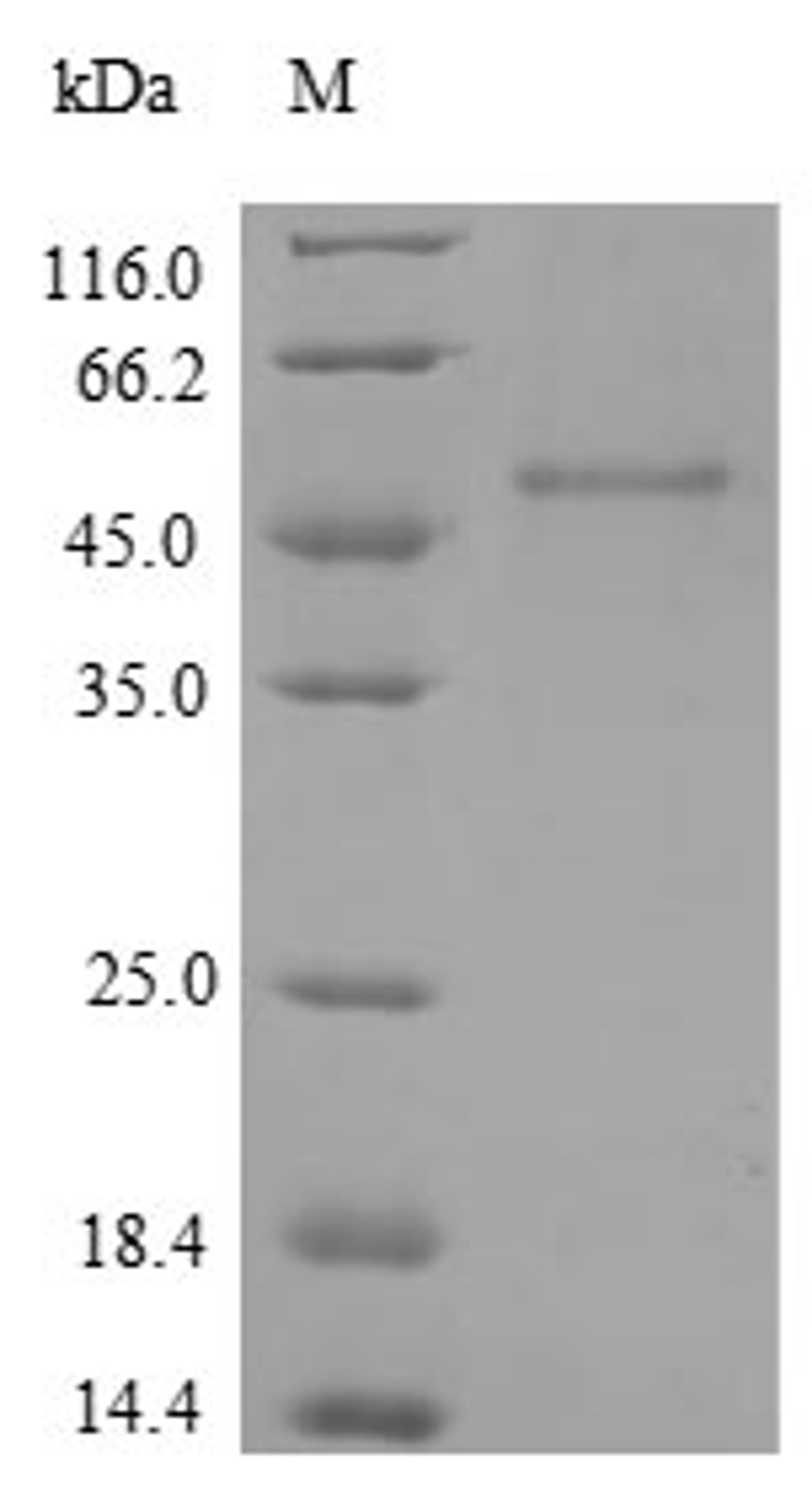 (Tris-Glycine gel) Discontinuous SDS-PAGE (reduced) with 5% enrichment gel and 15% separation gel.