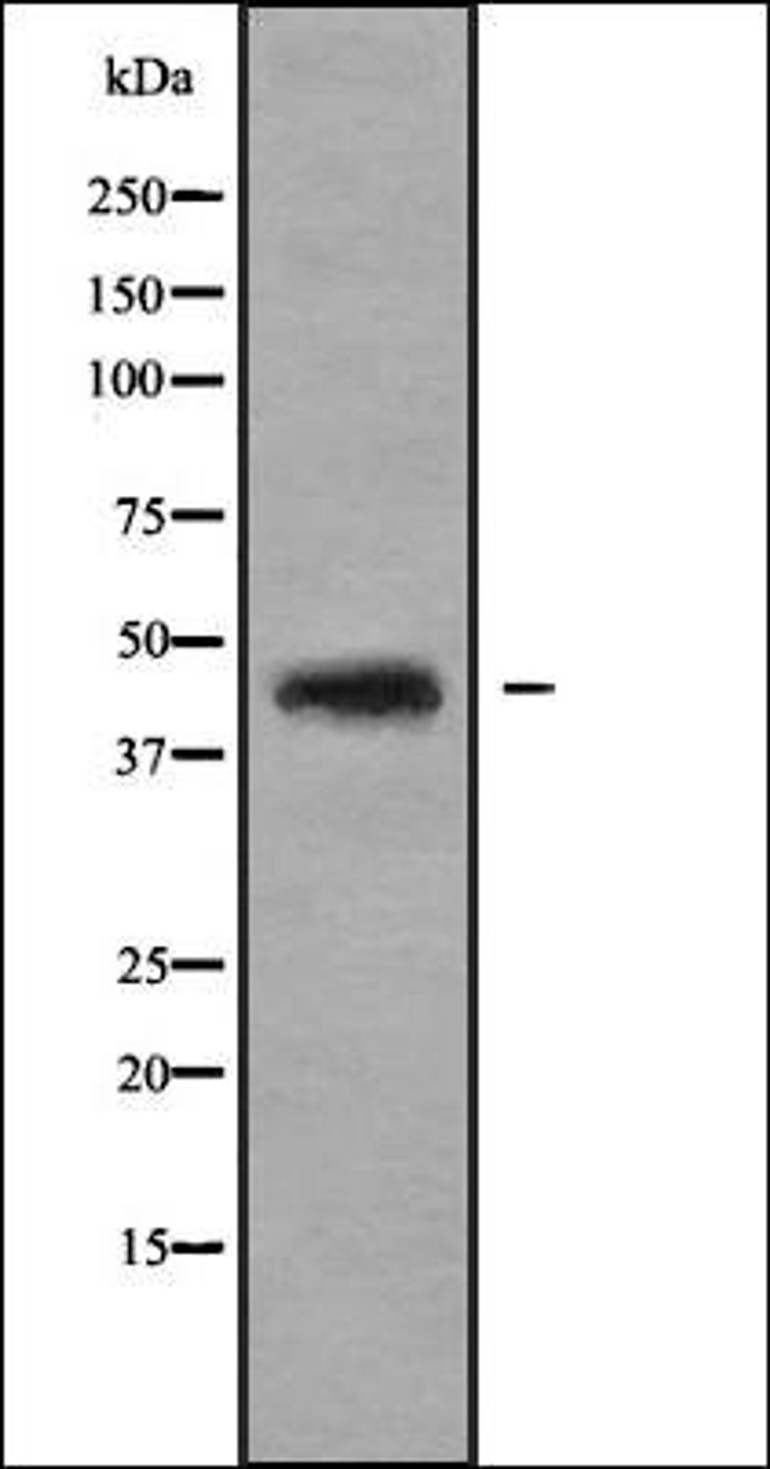 Western blot analysis of HEK293 cells using MANS1 antibody