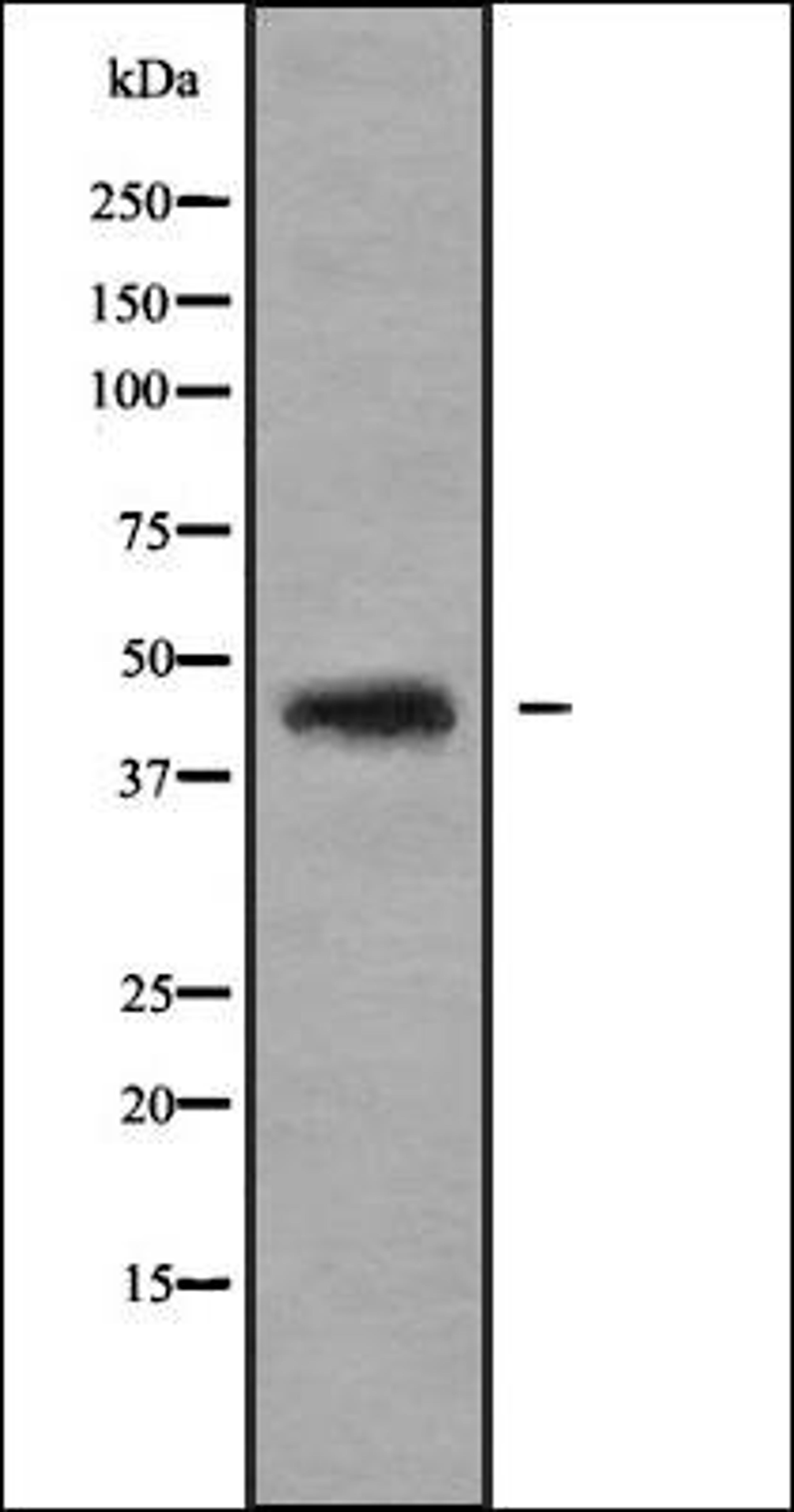 Western blot analysis of HEK293 cells using MANS1 antibody