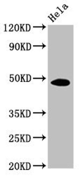 Western Blot. Positive WB detected in: Hela whole cell lysate . All lanes: MYC antibody at 1:500. Secondary. Goat polyclonal to mouse IgG at 1/50000 dilution. Predicted band size: 49, 51 KDa. Observed band size: 49 KDa. Exposure time：5min