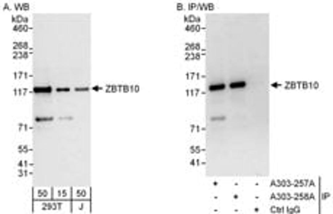 Detection of human ZBTB10 by western blot and immunoprecipitation.