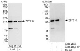 Detection of human ZBTB10 by western blot and immunoprecipitation.