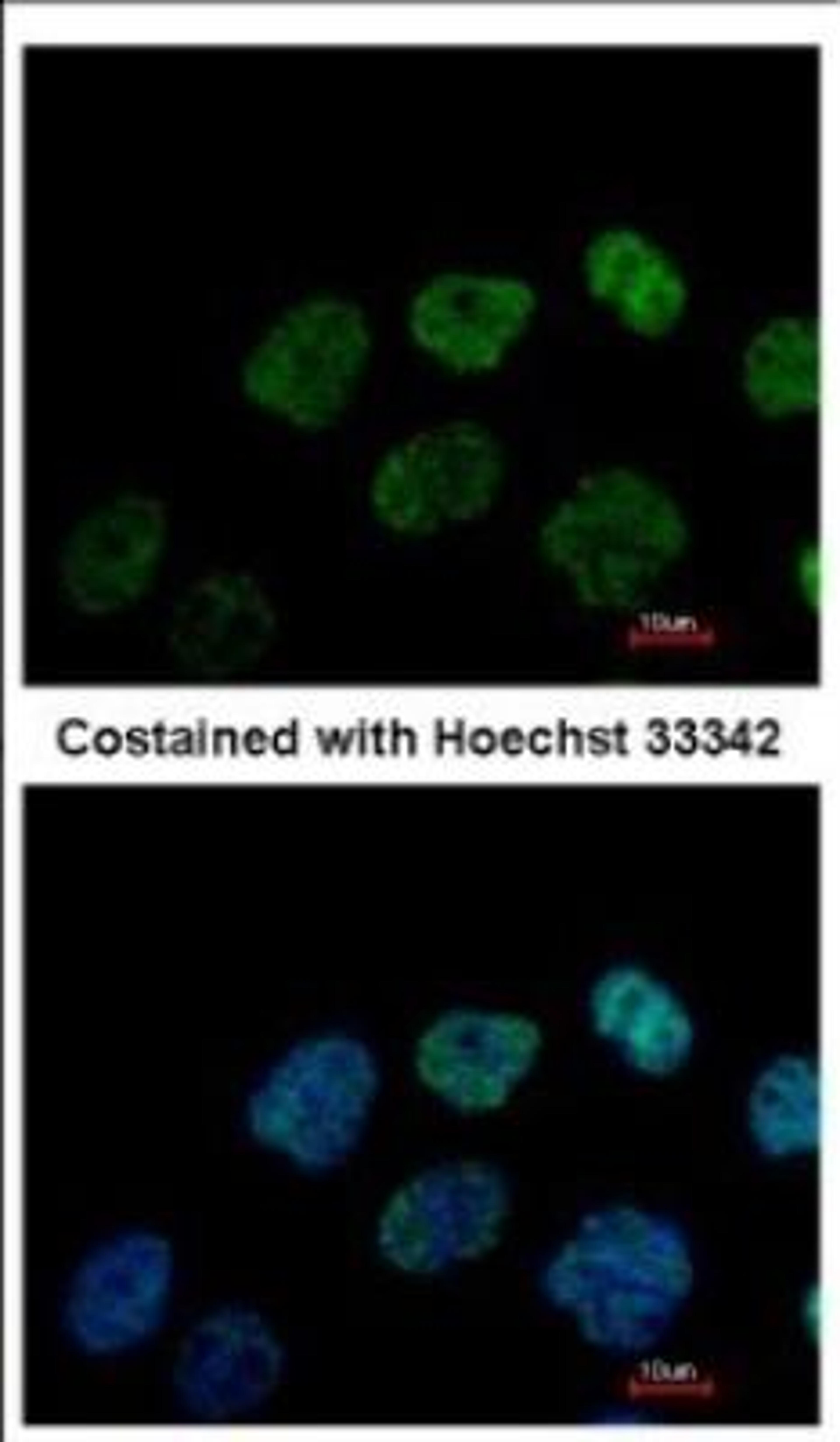 Immunocytochemistry/Immunofluorescence: GRWD1 Antibody [NBP2-16753] - Immunofluorescence analysis of paraformaldehyde-fixed A431, using antibody at 1:500 dilution.