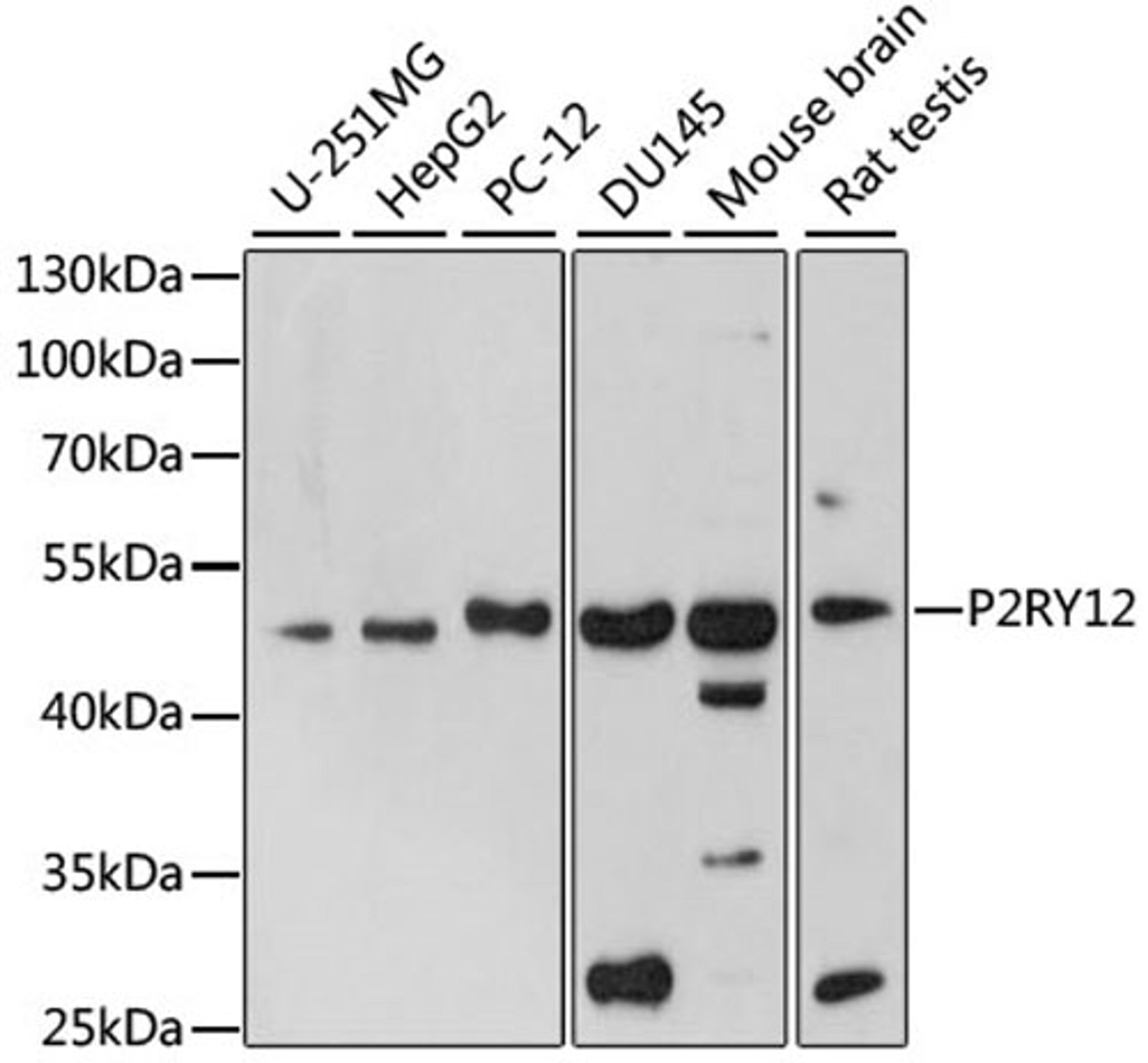 Western blot - P2RY12 antibody (A1710)