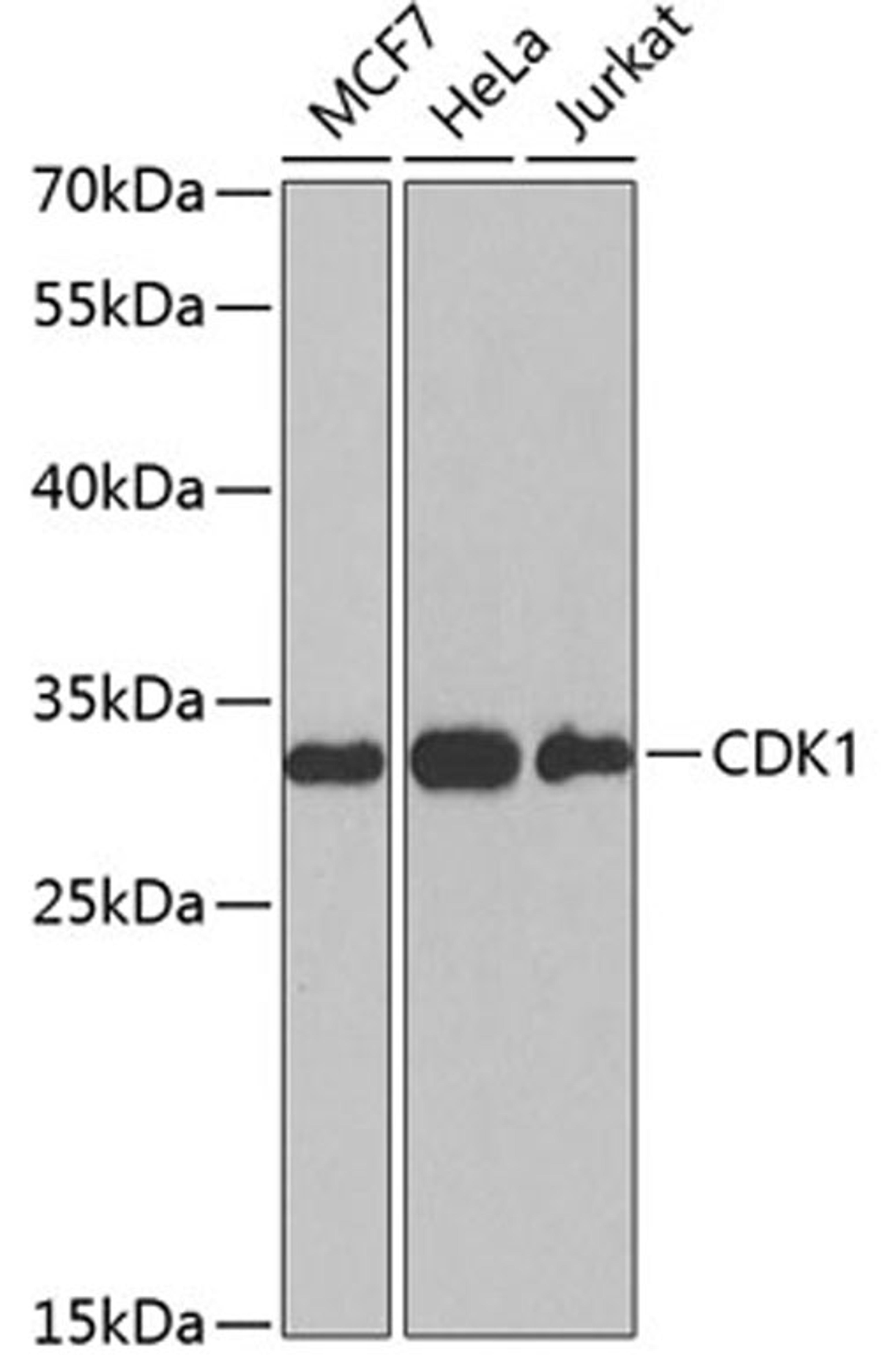 Western blot - CDK1 antibody (A12414)