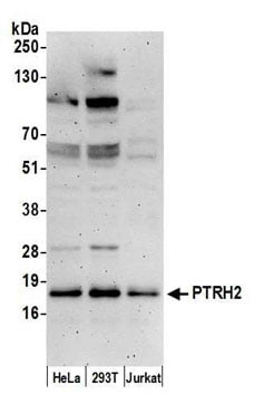 Detection of human PTRH2 by western blot.