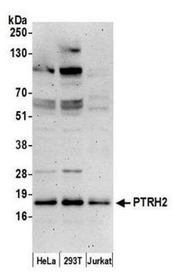 Detection of human PTRH2 by western blot.